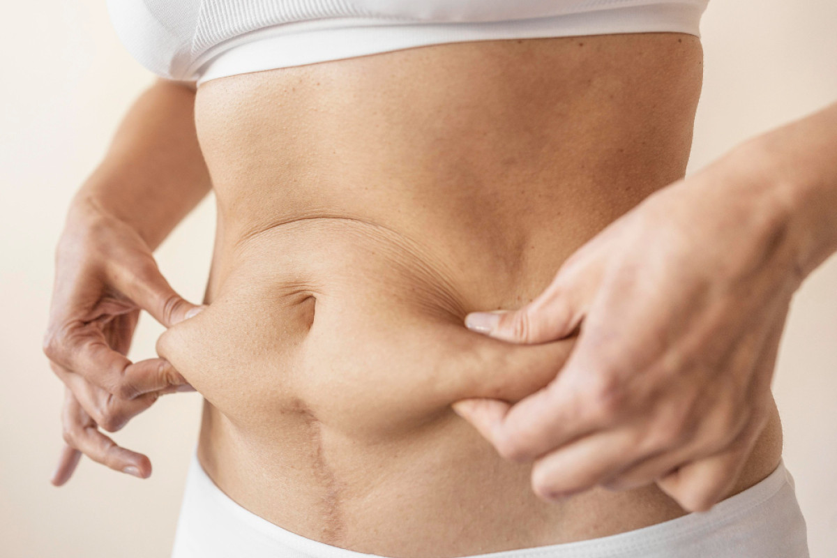 Flacidez na Menopausa: Tratamentos Não Invasivos para Recuperar a Firmeza da Pele