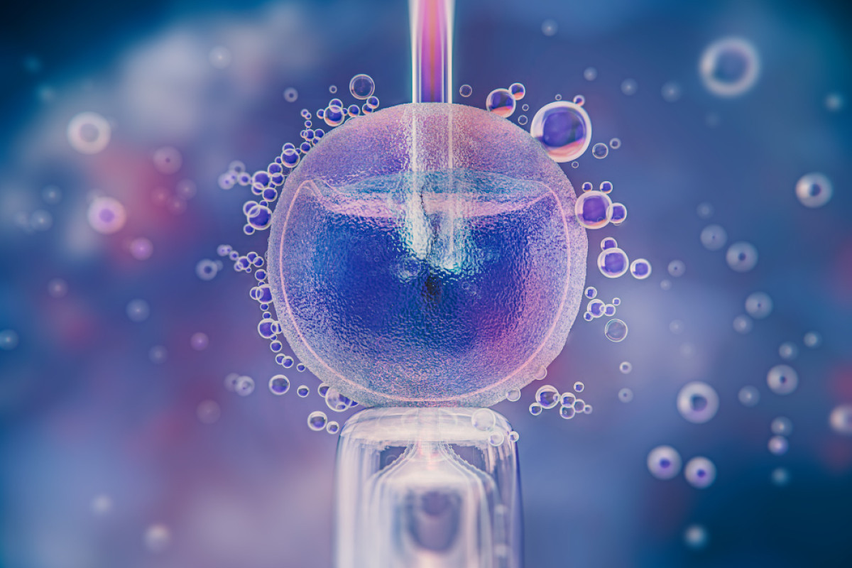 Fertilização In Vitro: Alternativa para Mulheres Laqueadas que Desejam Ter Filhos
