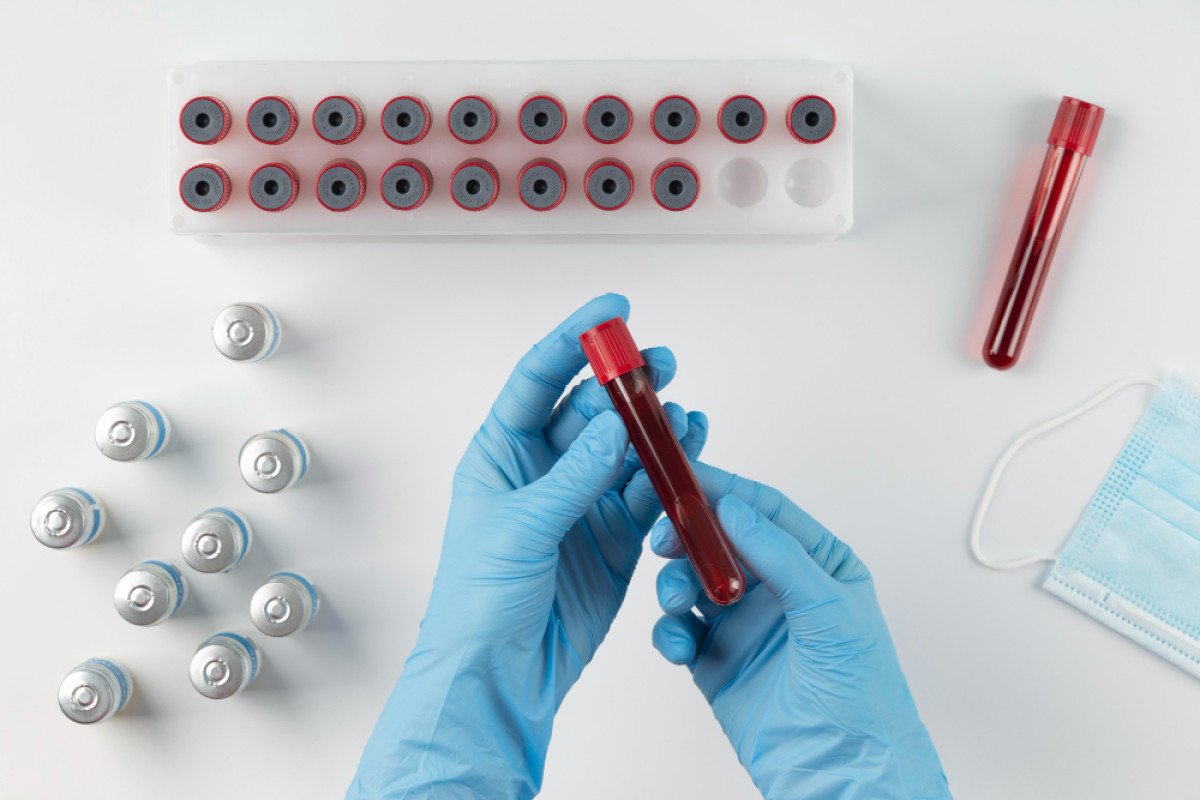 Policitemia Vera: Novas Perspectivas no Tratamento de uma Doença Rara do Sangue