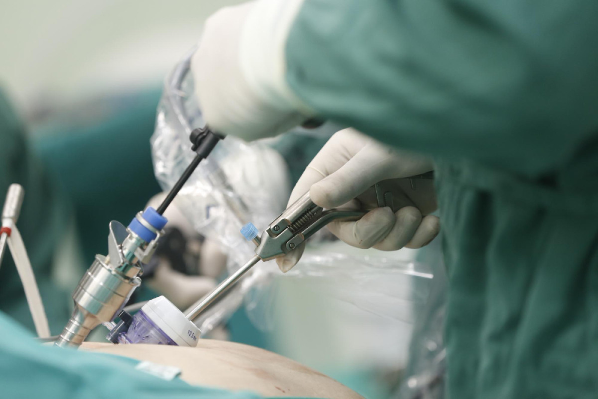 Cirurgia da vesícula por vídeo acelera a recuperação e não atrapalha a digestão
