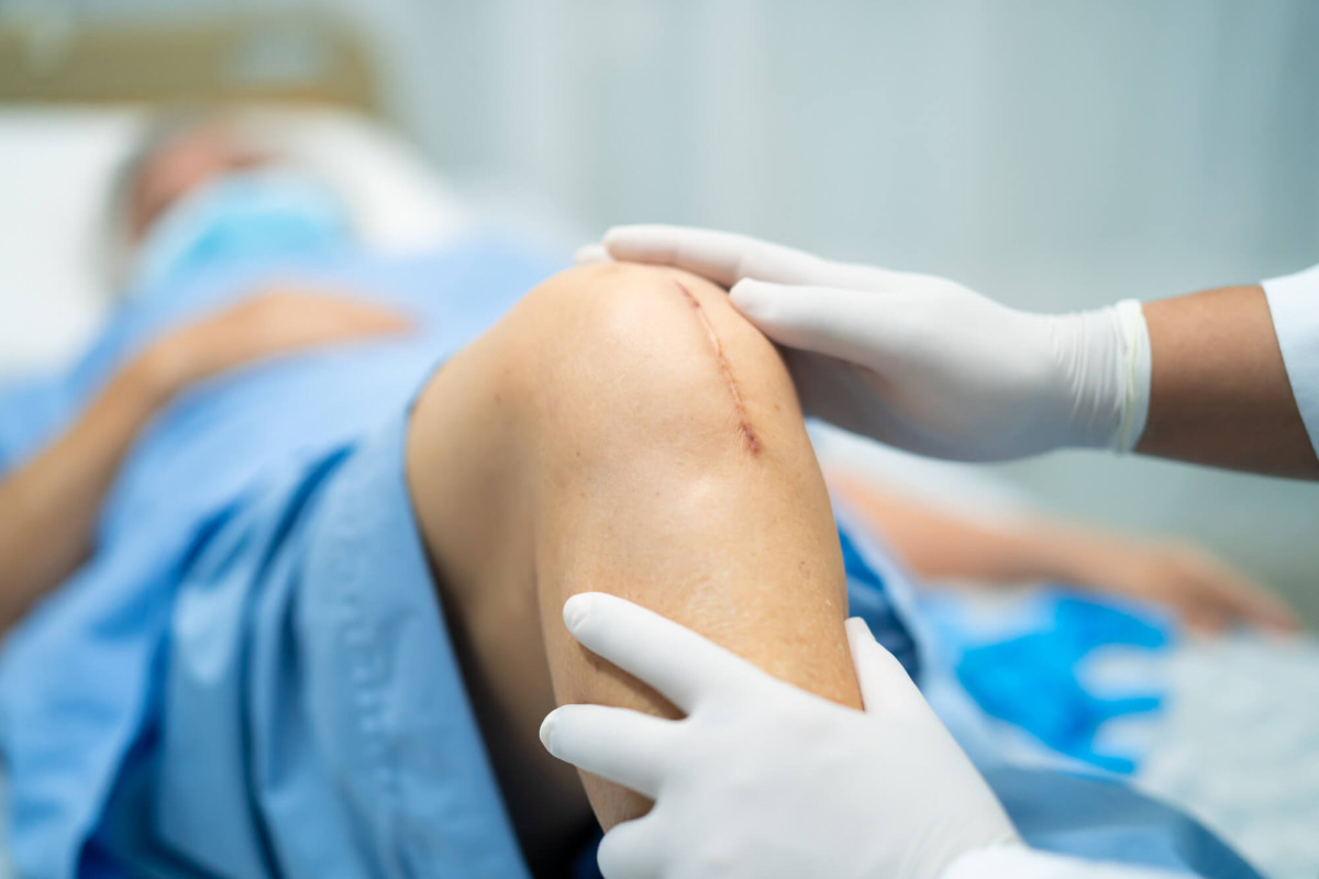 Inovações em Cirurgia de Joelho: O Que Já É Realidade e o Que Ainda Está em Estudo