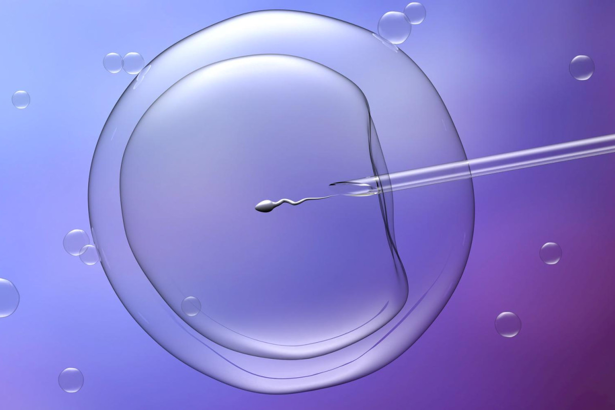 Inseminação Artificial x Fertilização in Vitro