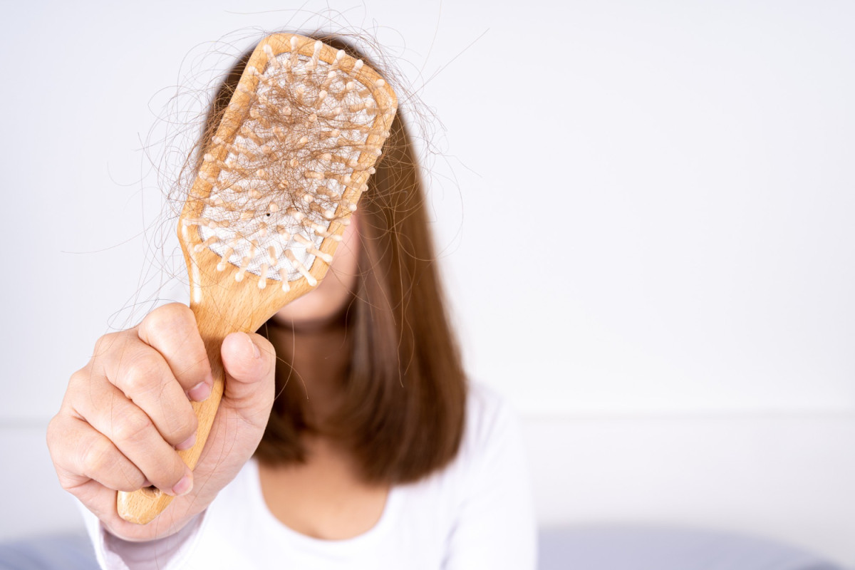 Por que tanta gente jovem está perdendo cabelo?