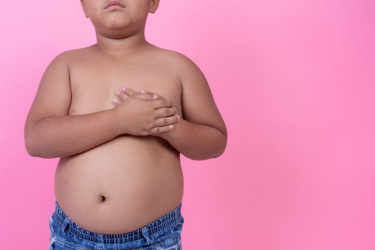 Obesidade Infantil
