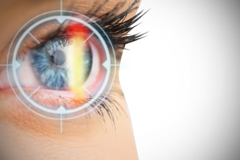 ceratocone_doenca_na_cornea_pode_ser_confundida_com_aumento_do_grau.jpg