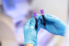 exame_de_sangue_promete_transformar_diagnostico_do_alzheimer_mas_nao_e_para_todos (1).jpg