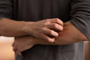casos_de_doenca_de_chagas_aumentam_no_brasil_e_acendem_alerta_para_transmissao_por_alimentos.jpg