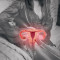sarcoma_uterino_o_tumor_raro_que_pode_ser_confundido_com_mioma (1).jpg
