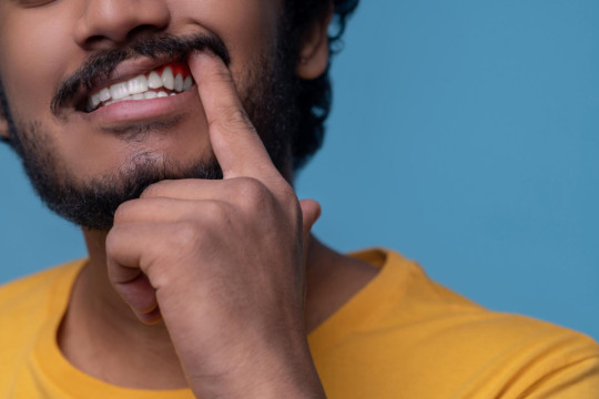 periodontite_pode_avancar_sem_dor_e_levar_a_perda_de_dentes_saiba_identificar.jpg