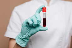 o_hemograma_pode_salvar_vidas_o_exame_simples_que_ajuda_a_detectar_anemia_leucemia_e_outras_doencas_graves.jpg