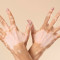 dia_mundial_do_vitiligo_alerta_para_mitos_e_impacto_emocional_das_manchas_na_pele.jpg