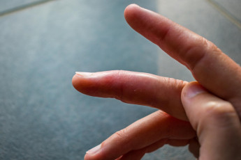 dedos_que_mudam_de_cor_no_frio_podem_indicar_fenomeno_de_raynaud.jpg