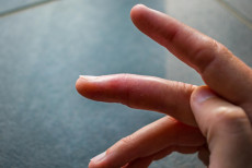 dedos_que_mudam_de_cor_no_frio_podem_indicar_fenomeno_de_raynaud.jpg
