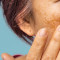 melasma_no_inverno_o_segredo_da_estacao_para_clarear_manchas_sem_ilusao.jpg