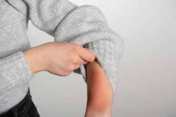 frio_e_ar_seco_podem_piorar_dermatite_atopica_e_prurigo_nodular_no_inverno.jpg