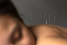 acupuntura_pode_ajudar_a_aliviar_sintomas_de_rinite_e_outras_alergias_no_inverno.jpg