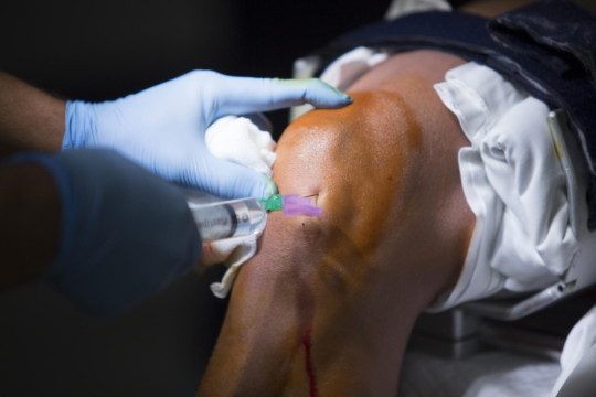 o_efeito_neymar_por_que_tantos_atletas_recorrem_ao_prp_e_o_que_a_medicina_realmente_sabe.jpg