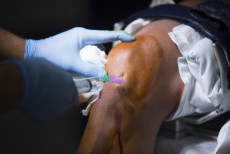 o_efeito_neymar_por_que_tantos_atletas_recorrem_ao_prp_e_o_que_a_medicina_realmente_sabe.jpg