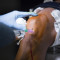 o_efeito_neymar_por_que_tantos_atletas_recorrem_ao_prp_e_o_que_a_medicina_realmente_sabe.jpg